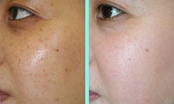 沈陽哪家醫(yī)院的面部整形效果好？