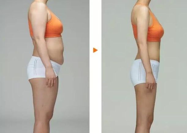 吉林哪家醫(yī)院做小腿溶脂減肥效果好？口碑推薦排行榜TOP10