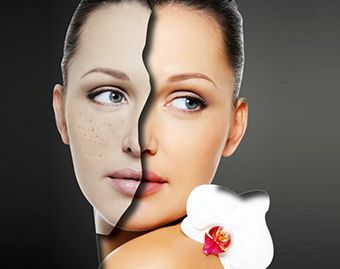 西安哪家醫(yī)院能改善面部下垂效果好？Top醫(yī)院排名揭曉