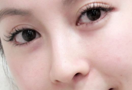 杭州眼底紋治療最佳醫(yī)院推薦TOP排行榜2024