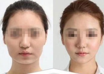 洛陽最佳發(fā)際線矯正整形醫(yī)院排行榜TOP10大揭秘