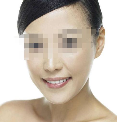 韓孫振東整形專家推薦的鼻部塑形技術(shù)