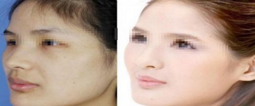 上海溶脂針瘦腰醫(yī)院口碑推薦10強榜單