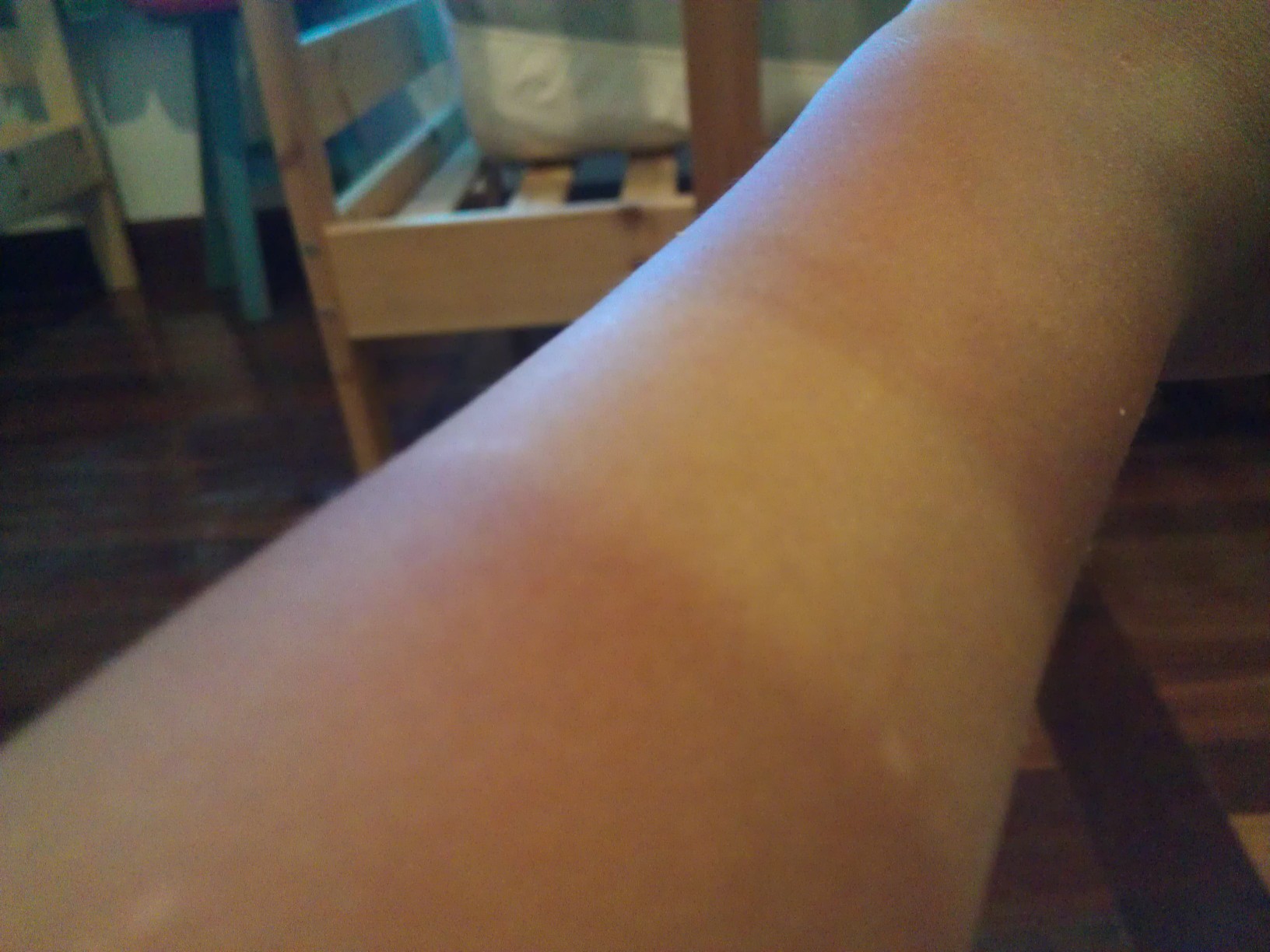 2023年無錫內(nèi)眼角去皺醫(yī)療整形醫(yī)院排名榜：10家具專業(yè)權(quán)威性的醫(yī)院推薦