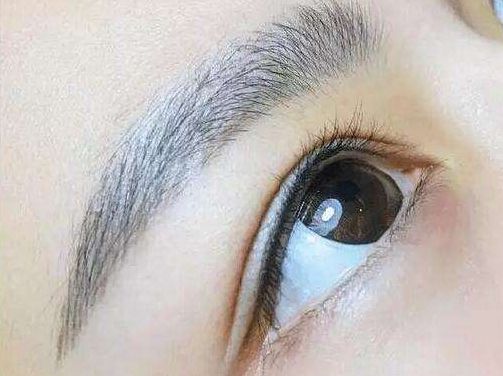 拓展：18歲了還需要考慮整容嗎？