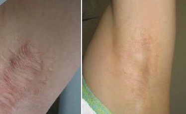 張檬是否真的承認(rèn)整容了？揭秘明星整容疑云