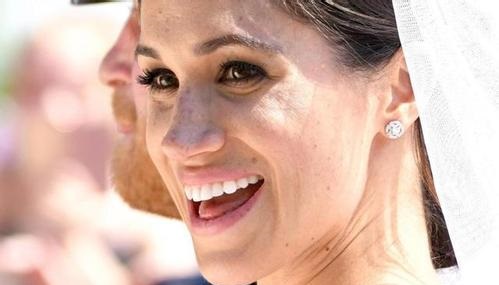 徐州眼角紋玻尿酸填充醫(yī)療美容醫(yī)院哪家聲譽(yù)好？2023年徐州眼角紋填充醫(yī)療整形醫(yī)院前十名榜單民眾評(píng)選！