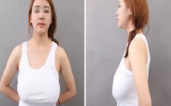 北京微雕淡化口周紋口碑佳選：10家實力醫(yī)院推薦