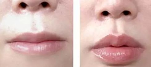 綿陽茗匯整形美容醫(yī)院醫(yī)生專家團隊靠譜嗎？效果真的好嗎？