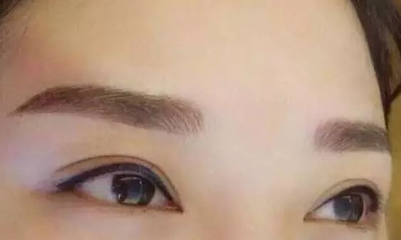 青島哪家植發(fā)醫(yī)院效果好？發(fā)際線種植費(fèi)用介紹