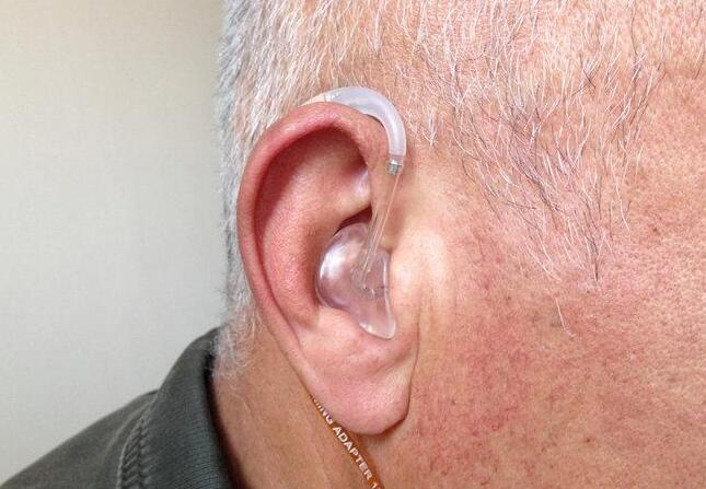 隨著時(shí)間的推移，硅膠隆鼻的效果如何？它能持續(xù)多久呢？