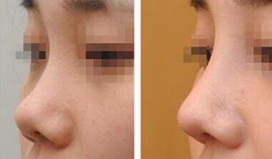 清遠(yuǎn)有哪些醫(yī)院是整容專業(yè)的？其中前十名的整容醫(yī)院是哪些？手術(shù)費(fèi)用怎樣？