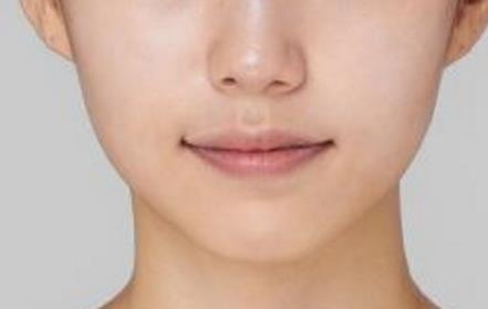 寧波唇紋埋線(xiàn)整形醫(yī)院推薦！2023年備受好評(píng)的前10家醫(yī)院排名揭曉！