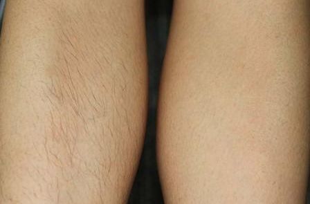 上海法令紋打針排行榜前十大醫(yī)院分享