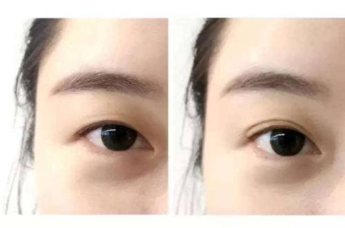 揭秘桂林自體填充眼底紋醫(yī)院10大高性價(jià)比選擇！2023最全攻略揭曉！