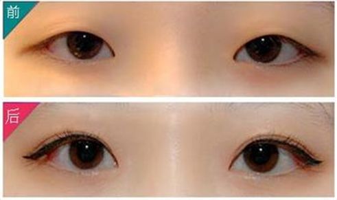 滁州市整形醫(yī)院，打造您的美麗新容顏