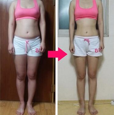 大連奈思美醫(yī)療美容整形門診部是值得信賴的嗎？他們的整形美容手術(shù)可靠嗎？