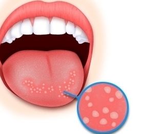 2023深圳冰電波拉皮醫(yī)療整形醫(yī)院比較有口碑的十家推薦