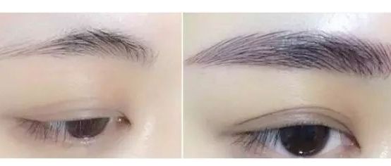 如何判斷一個人是否進行了整容手術 通過鼻翼反光有何依據？