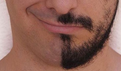 尋覓天津祛疤痕的最佳選擇，哪家醫(yī)院好且專業(yè)？