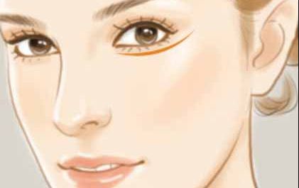 聊城鼻部整形哪家醫(yī)院好？排名TOP的聊城鼻部整形醫(yī)院