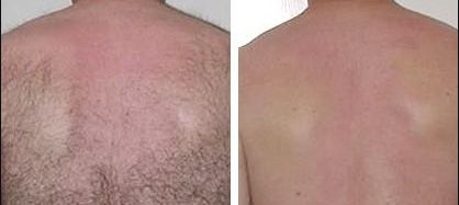 庫爾勒哪家整形醫(yī)院靠譜？排名最好的整形美容醫(yī)院在哪里？