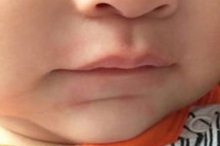 北京豐面頰整形醫(yī)院哪家好？看看全網(wǎng)口碑，找到最靠譜的整形醫(yī)院