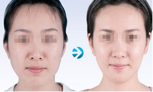 昆山顯微鏡根管治療哪家好？口碑佳的整形醫(yī)院推薦