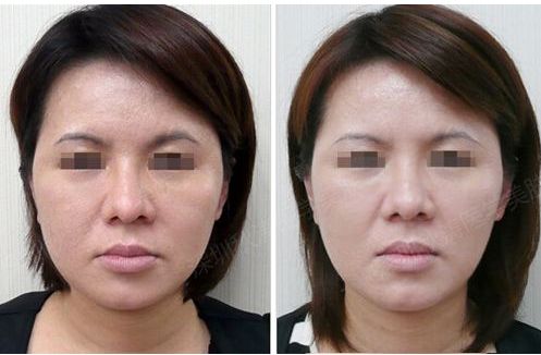 武漢十家技術(shù)精湛的整形醫(yī)院盤點，靈動媚眼術(shù)醫(yī)療實力與口碑齊飛！