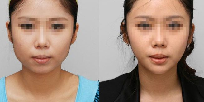 北京腿部護理實力醫(yī)院前十強排名揭曉！Top10醫(yī)療整形機構盤點