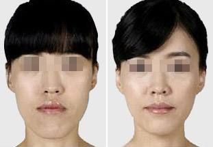 揭秘杭州十大聲譽(yù)卓著的去眼紋整形醫(yī)院推薦