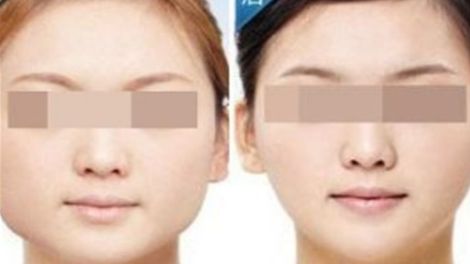 南昌十家口碑卓著的吸脂瘦身美容醫(yī)院推薦