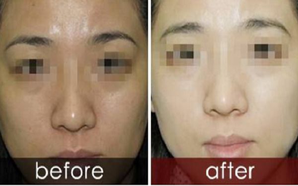 保定眉間紋注射除皺醫(yī)院推薦  前十強(qiáng)醫(yī)院排行榜