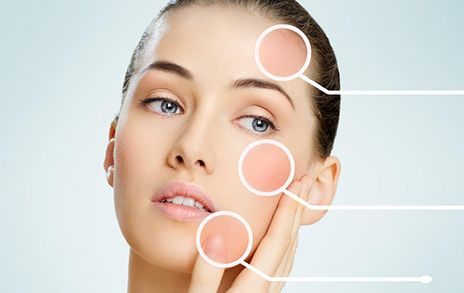 美容科技百科——黃金微針：功效全解析，有何獨特之處？