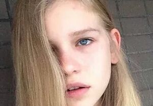 告別黃褐斑的7大有效方法，讓肌膚重現(xiàn)光彩