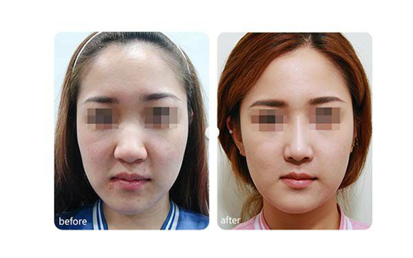 太原淡化頸紋推薦十大口碑醫(yī)院，預(yù)約火爆!