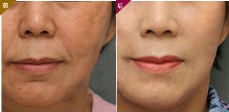 百雀羚適合的年齡段和有哪些系列產(chǎn)品？市面上好評(píng)如潮！