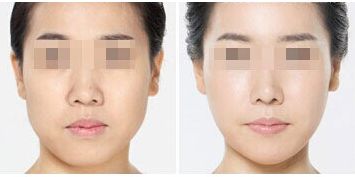 青島實(shí)力派熱瑪吉修復(fù)痘坑十強(qiáng)醫(yī)美機(jī)構(gòu)口碑大揭秘