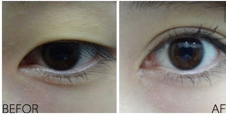 徐雨整容了嗎？看看她引領(lǐng)的新時(shí)尚引起的變化！