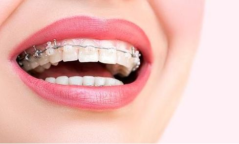 昆明哪家醫(yī)院的吸脂瘦身效果好？