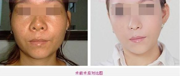 北京頸部水光針祛皺醫(yī)院排行榜TOP10揭曉！各醫(yī)院優(yōu)勢大揭秘！