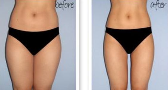 【2023】威海黃金微針去細(xì)紋醫(yī)院排行榜前十強公開！