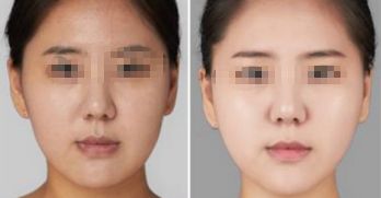 遼寧熱拉提眼袋醫(yī)院排名TOP10，哪家最專(zhuān)業(yè)？