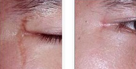 上海有哪些正規(guī)除疤醫(yī)院值得推薦？