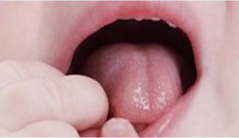 南京眼袋手術哪家醫(yī)院好？從資深專家解析，推薦適合您的最佳選擇