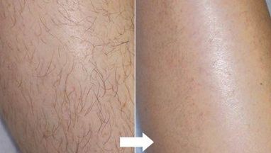 臨沂哪家醫(yī)院眼部整形好？全面解析眼部整形項目及醫(yī)院選擇攻略