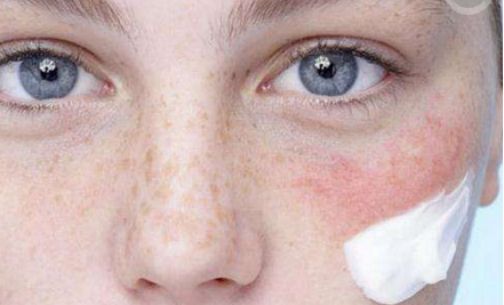 姜素拉整容了嗎？解讀姜素拉近期頻繁外貌變化的原因