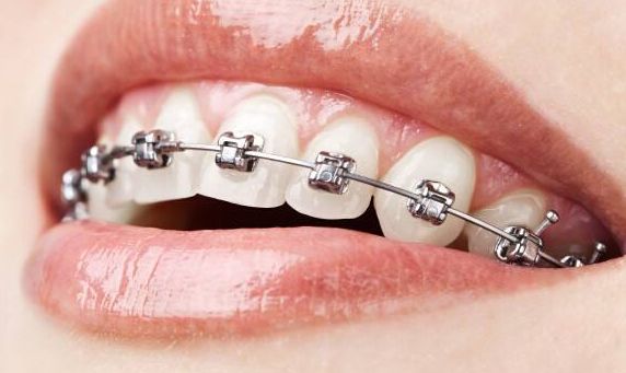 徐州哪家三甲醫(yī)院的鼻部整形效果最佳？