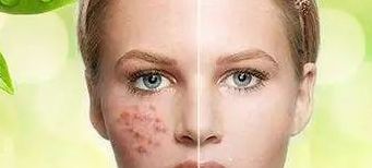 火爆集結(jié)！蘇州私立整形醫(yī)院專業(yè)技術(shù)備受推崇！