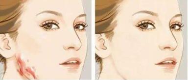 怎樣才能擁有高挺的鼻梁？無需整形手術，學會這幾招！